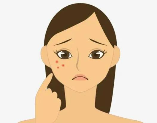 為什么洗完臉痘印會(huì)看起來(lái)很紅?為什么照鏡子看不到痘印拍照就有 為什么洗完臉痘印會(huì)看起來(lái)很紅?為什么照鏡子看不到痘印拍照就有