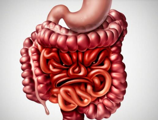 結(jié)腸炎小腸炎有哪些區(qū)別?潰瘍性結(jié)腸炎會(huì)肚子疼嗎 結(jié)腸炎小腸炎有哪些區(qū)別?潰瘍性結(jié)腸炎會(huì)肚子疼嗎